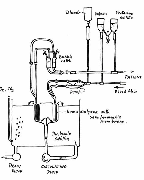 Dialysis system Mechanism